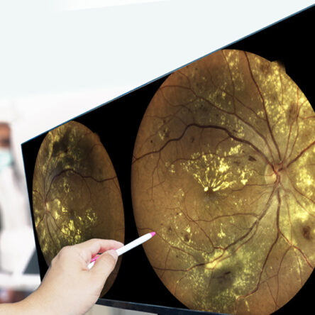 Digital Retina Imaging