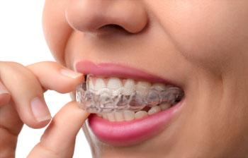 free-consultation-for-invisalign